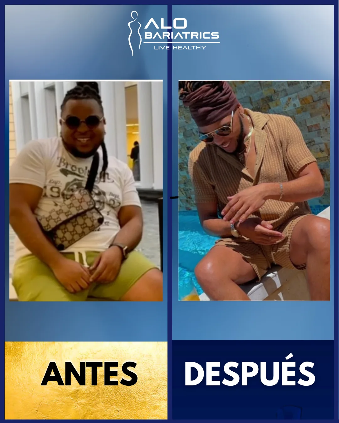 Bariatric surgery before and after — patient 36
