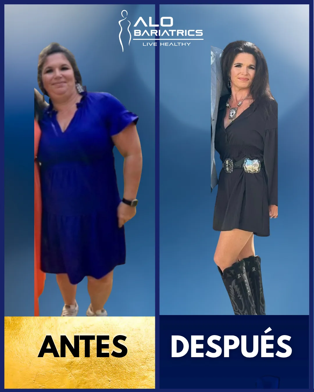 Bariatric surgery before and after — patient 7
