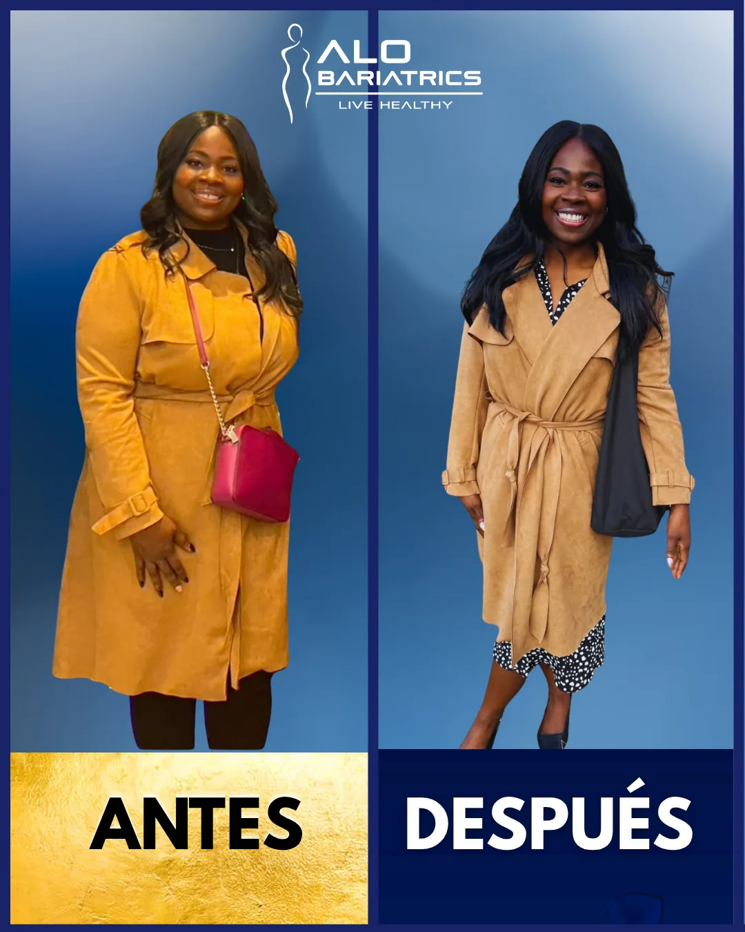Bariatric surgery before and after — patient 8